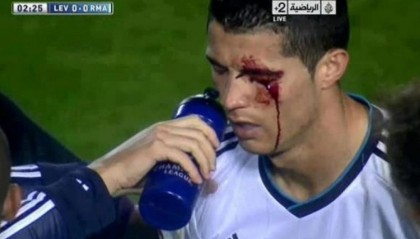 世界杯手机观看-莱万特旧将：我过去曾无意肘击C罗，媒体却几乎要把我关进监狱